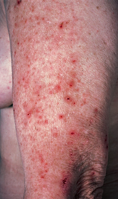 Skin rash: Common Related Symptoms and Medical Conditions